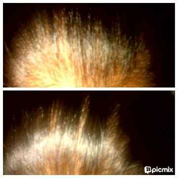 MOTHERS DAY SPECIAL -HAIR LOSS - PEANIE HAIR GROWTH TONIC - shipping R30-00 Get yours now!!!!