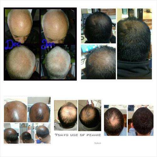 LOSING YOUR HAIR??? PRO BODY BUILDERS ?? - 2 BOTTLES @R175.00 EACH - PEANIE HAIR GROWTH TONIC !!!!