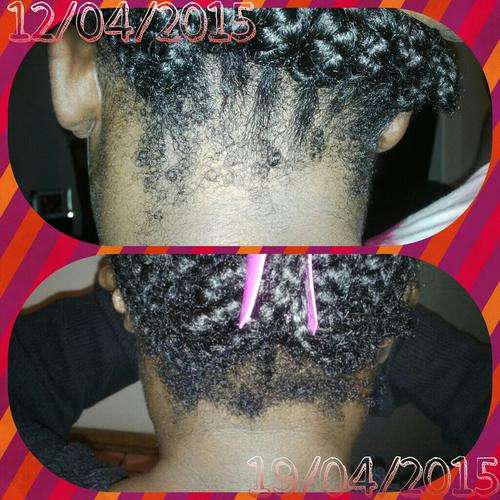ETHNIC HAIR LOSS ? BRAIDING - HAIR GLUE DAMAGE - 2 BOTTLES FOR R350 - PEANIE HAIR GROWTH TONIC !!!!