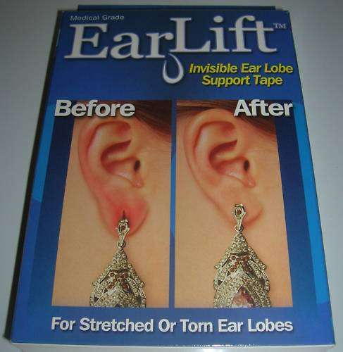 Plastic Surgery - No way !! Ear Lift Tabs (60 applications)