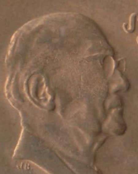 SOUTH AFRICA MINT ERROR 1976 2 CENTS x 2 WEAK STRIKE - PART MISSING GLASSES, CHEEK BONE&HAIRLINES