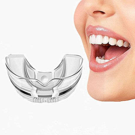 Orthodontic Appliance Silicone Simulation Braces Anti-Molar Braces (Third Stage)