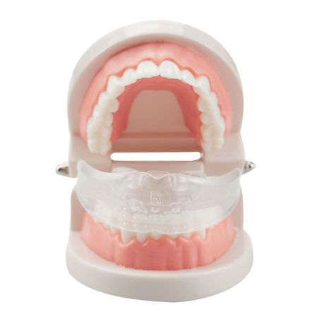 Orthodontic Appliance Silicone Simulation Braces Anti-Molar Braces (Third Stage)