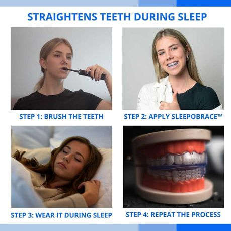 Orthodontic Dental Braces Anti-molar for Night (second stage) Orthodontic Teeth Alignment Appliance