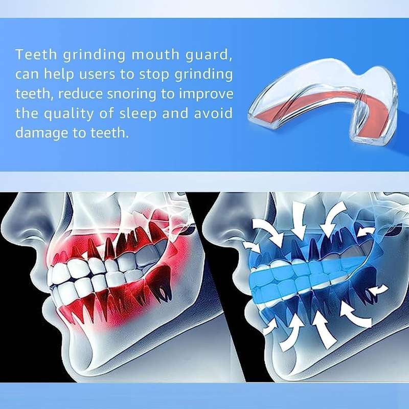 Rest Well Anti-Grinding Dental Guard