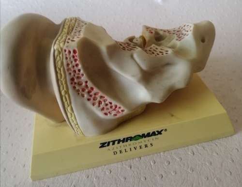Pfizer inner ear medical display