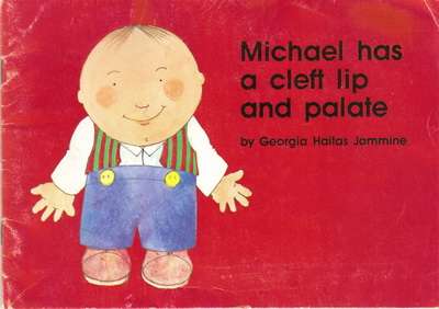 Michael has a cleft lip and palate by Georgia Haitas Jammine