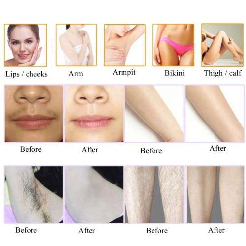ILP Hair Removal Handset