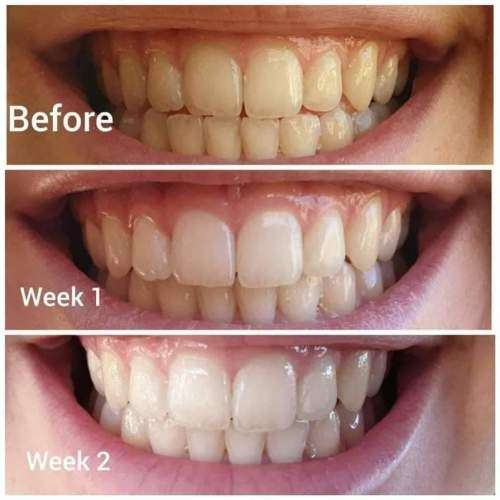 AP 24 Whitening Fluoride Toothpaste