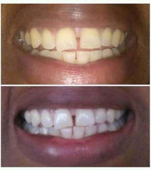AP 24 Whitening Fluoride Toothpaste