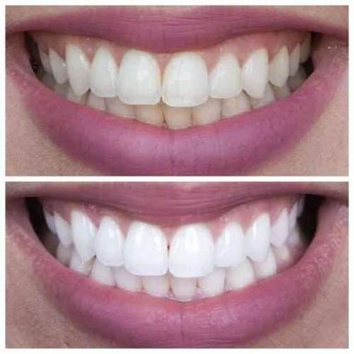 AP 24 Whitening Fluoride Toothpaste