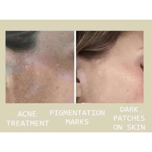 Epoch Polishing Bar Soap-free Face and Body Exfoliating Cleansing Bar