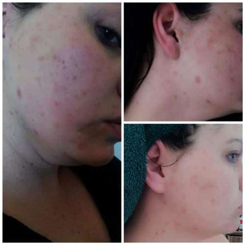 Epoch Polishing Bar Soap-free Face and Body Exfoliating Cleansing Bar