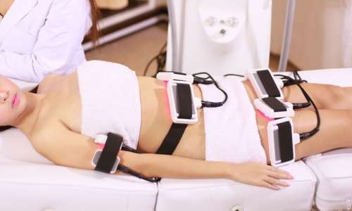 Laser Lipo x 4 Sessions at Brazen Beauty Bar - Randburg, Johannesburg