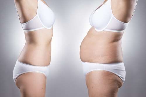Laser Lipo x 4 Sessions at Brazen Beauty Bar - Randburg, Johannesburg