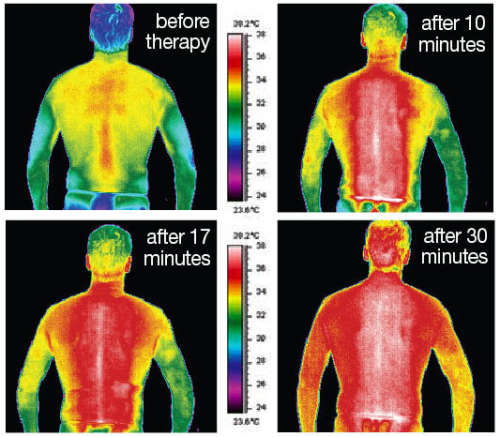 Special Laser Lipo Package Deal @ Brazen Beauty Bar