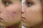 The Miracle Healer   AFRICAN POTATO CREAM!