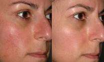 REVIVE - YOUR SECRET WEAPON FOR YOUTHFUL SKIN!