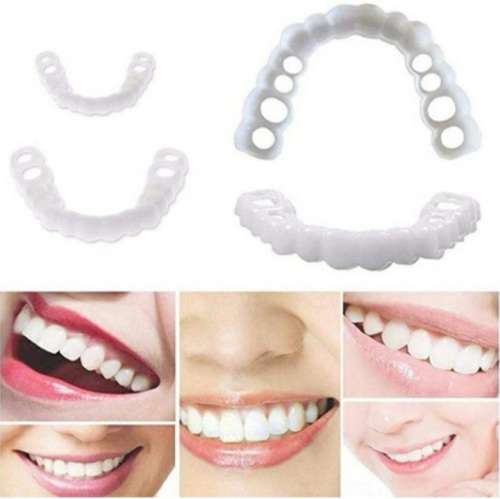 Instant snap on smile mold