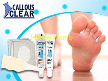 Callous Clear Foot Treatment, Everything you need for Softer feet !!
