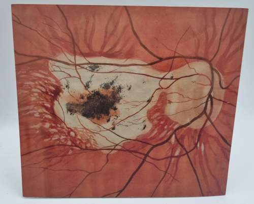 Tinus De Jongh as a Medical Artist - Janet Hodgson | Signed