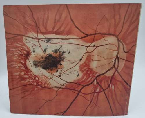 Tinus De Jongh as a Medical Artist - Janet Hodgson | Signed