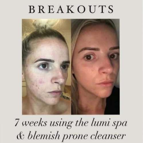 *AUTHENTIC* ageLOC LumiSpa Beauty Device Face Cleansing Kit + Activating Cleanser of Your Choice