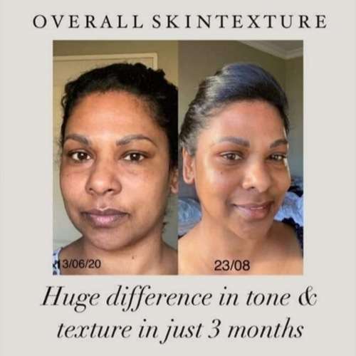 *AUTHENTIC* ageLOC LumiSpa Beauty Device Face Cleansing Kit + Activating Cleanser of Your Choice