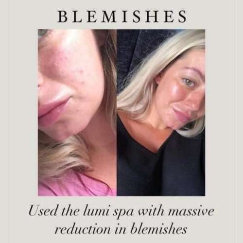 *AUTHENTIC* ageLOC LumiSpa Beauty Device Face Cleansing Kit + Activating Cleanser of Your Choice