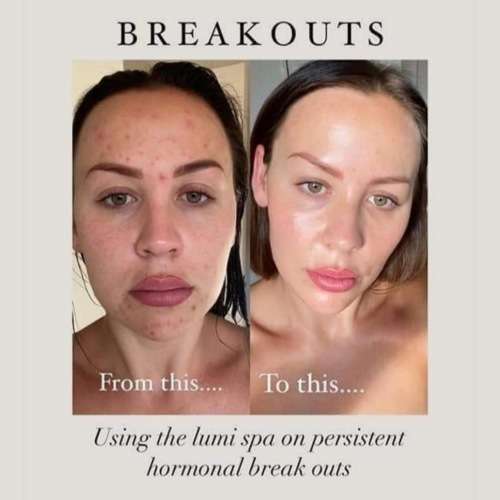 *AUTHENTIC* ageLOC LumiSpa Beauty Device Face Cleansing Kit + Activating Cleanser of Your Choice