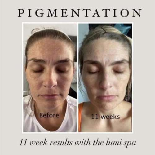 *AUTHENTIC* ageLOC LumiSpa Beauty Device Face Cleansing Kit + Activating Cleanser of Your Choice