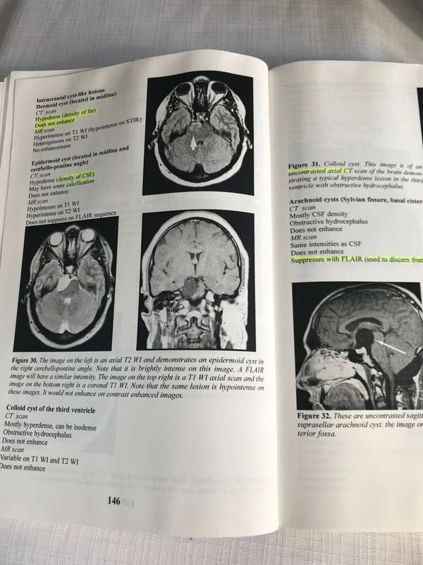 Neurosurgery Explained W Adriaan Liebenberg