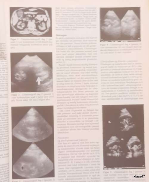 Journal of the Norwegian Medical Association - 25/1992
