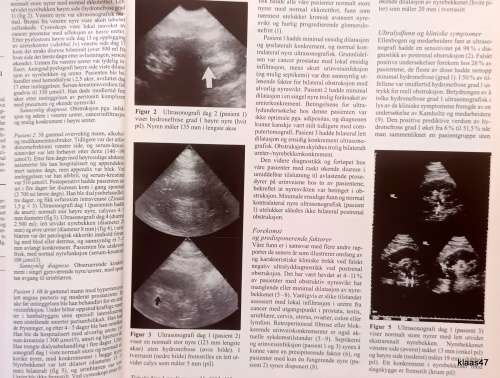 Journal of the Norwegian Medical Association - 25/1992