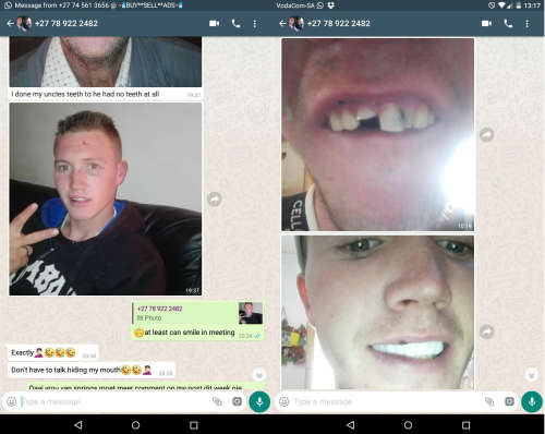 A VENEER MAGIC SMILE
