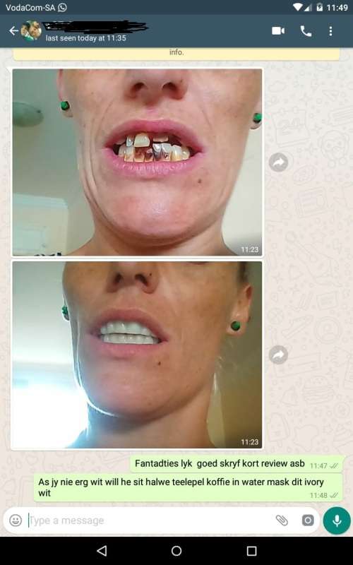 A VENEER MAGIC SMILE