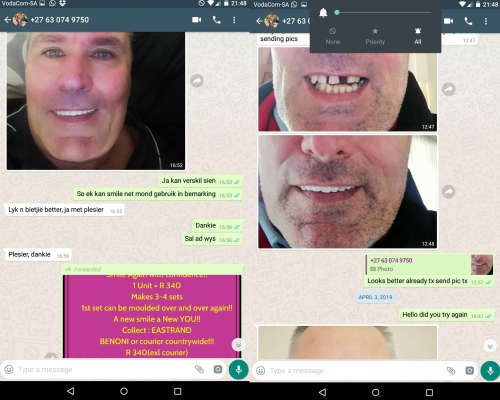 A VENEER MAGIC SMILE