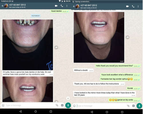 A VENEER MAGIC SMILE