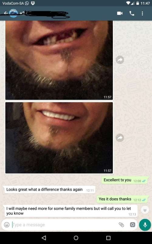 A VENEER MAGIC SMILE