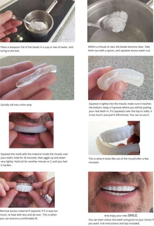 INSTANT SMILE VENEER KIT