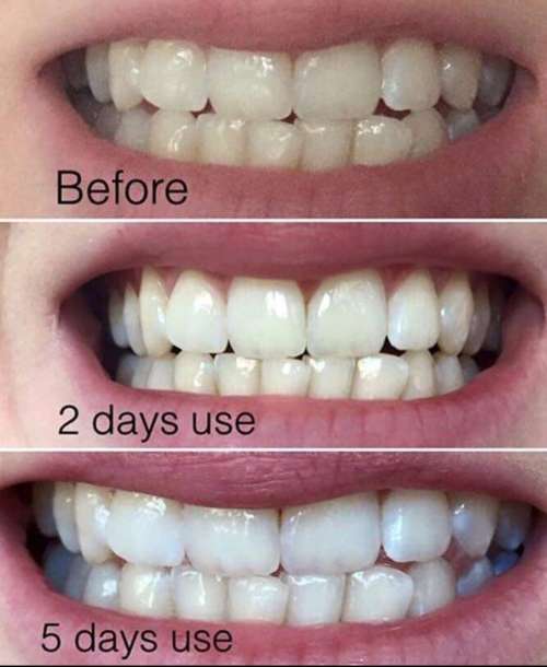AP 24 Whitening Fluoride Toothpaste