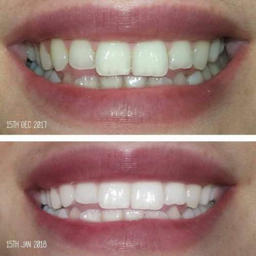 AP 24 Whitening Fluoride Toothpaste