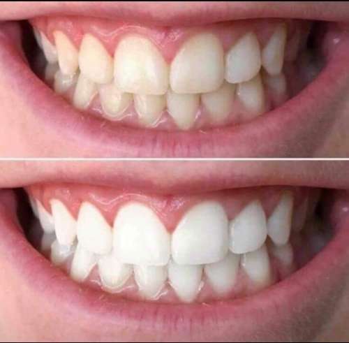 AP 24 Whitening Fluoride Toothpaste