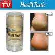 Heel Tastic - WATCH DRY,CRACKED HEELS DISAPPEAR!!!