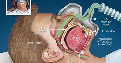 Philips System One REMstar Auto with A-Flex CPAP Machine, with humidifier tank, demo like new