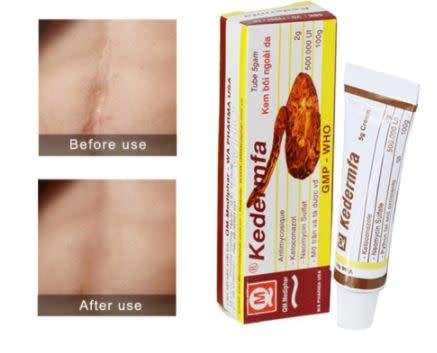 BEST SCAR AND ACNE TREATMENT -  Snake Balm Ointment 5g/Tube Nourishing