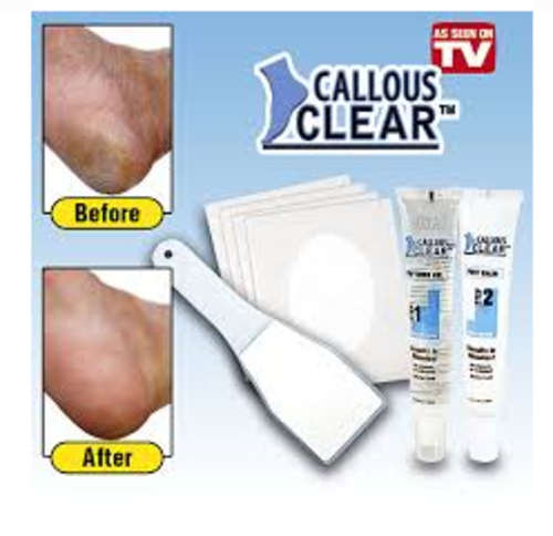 Callous Clear - Removes Calluses in Minutes
