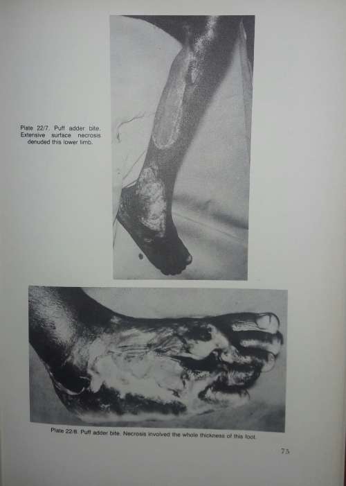 Snakes And SnakeBite - John Visser and David S Chapman