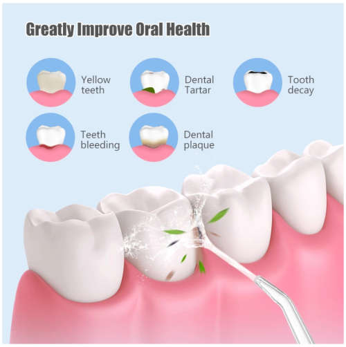 Oral Irrigator Portable Dental Water Flosser USB Rechargeable Water Jet Floss Tooth Pick 4 Jet Tip