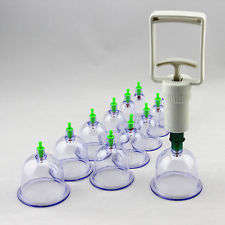 Cupping Pull out a Vacuum Apparatus  - LOW POSTAGE!!!